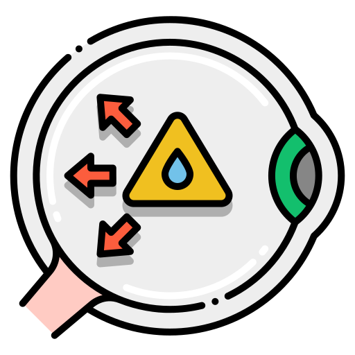 Glaucoma Evaluation & Management_image