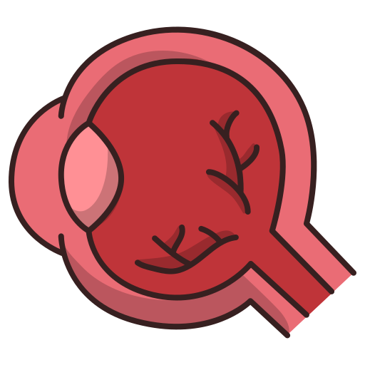 retinaldisorder-image