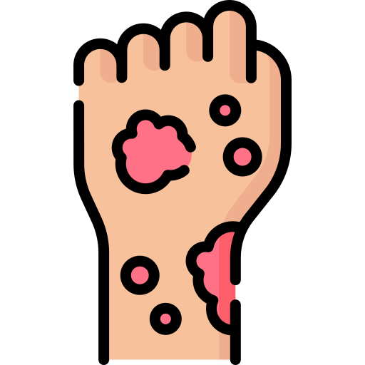rash
