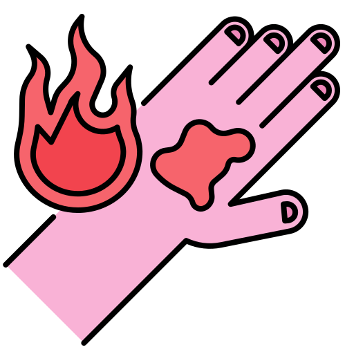 burn